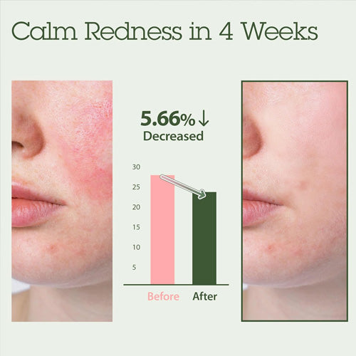 [BLITHE] Vital Treatment 6 calming Leaves