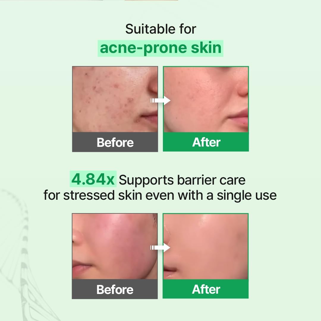 [zipiderm] EGF Skin Barrier Cream Toner 150ml