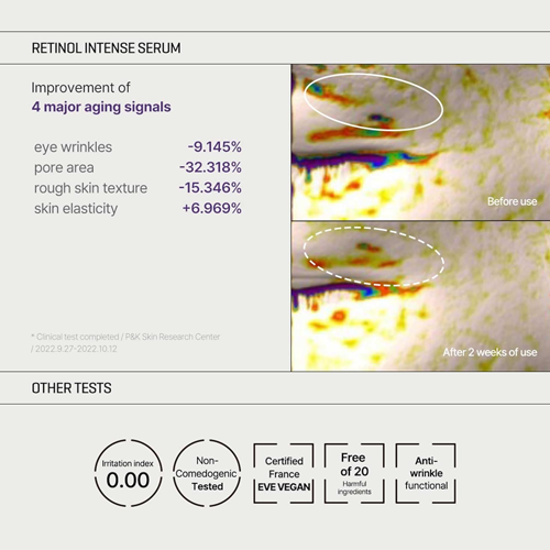 [SOMEBYMI] Retinol Intense Trial Kit