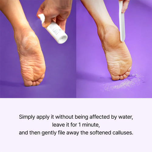 [baren] Callus Remover Peeling Foot Spray 100ml