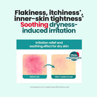 [Dr.G] Red Blemish Clear Moisture Cream 70ml
