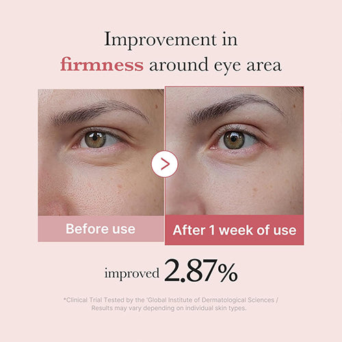[Medicube] PDRN Pink Eye Serum 30ml