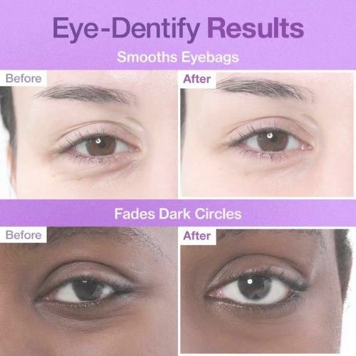 [Numbuzin] No.9 NAD Under Eye Patches (5ea)