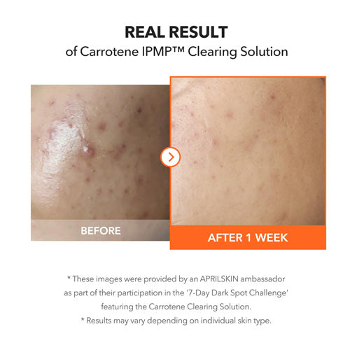 [APRILSKIN] Carrotene Clearing Solution 20ml