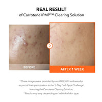 [APRILSKIN] Carrotene Clearing Solution 20ml