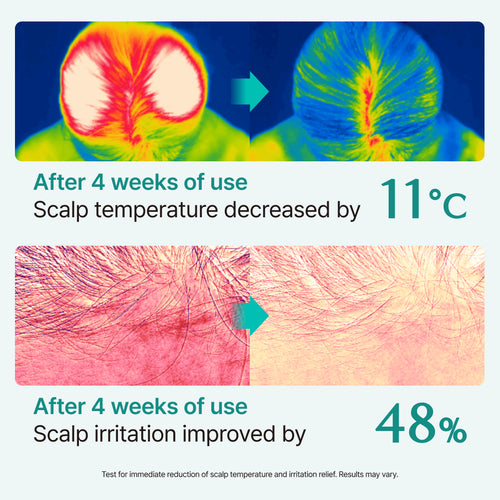 [Lilyeve] Scalp:Turn Cica PDRN Brush Ampoule 30ml