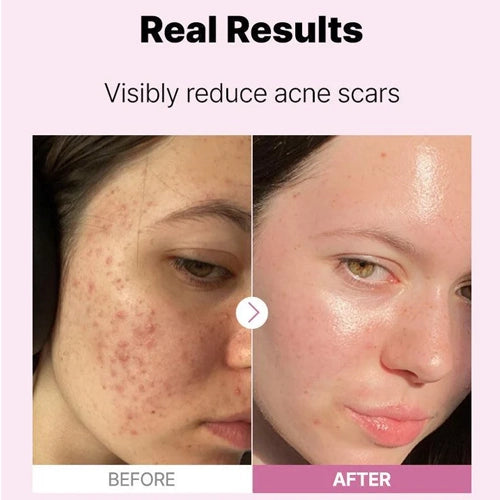 [COSRX] The Niacinamide 15 Serum 20 mL