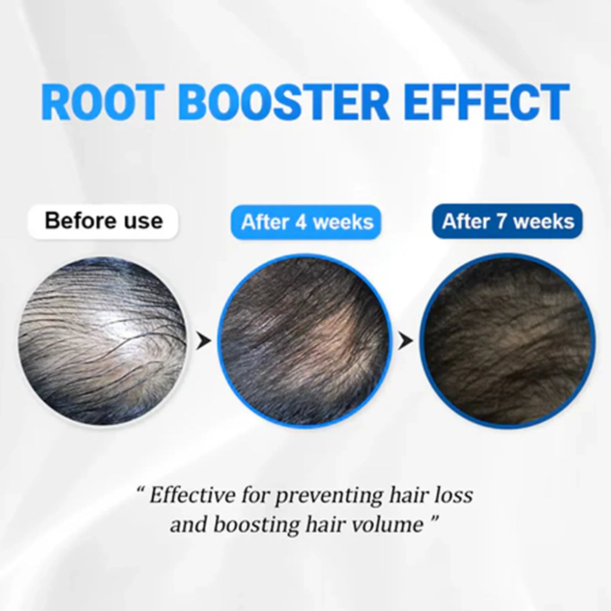 MOIDA SET [MOIDA] Viral Scalp & Root Strengthening Duo (lilyeve + Seapuri) *Special Price*