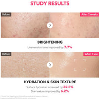 [APRILSKIN] TXA Niacinamide 99 Milky Toner 150ml