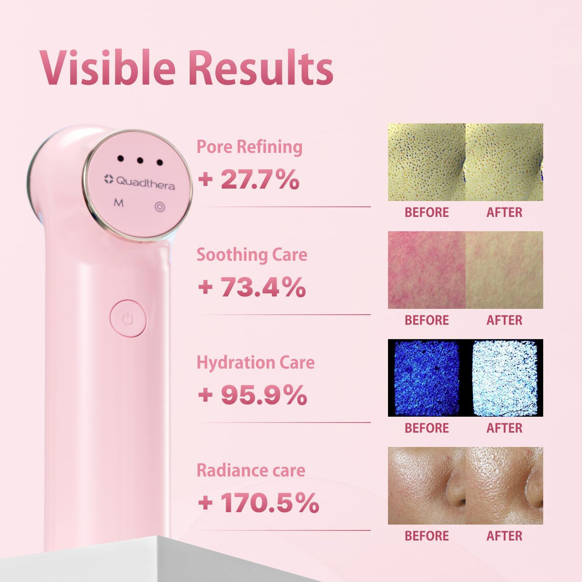 MOIDA SET Collagen Firming Spa Set (Quadthera Minitune (Pink) + Collagen Serum+ Collagen Cream)  *Special Price*