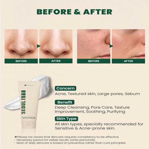 [KSECRET] SEOUL 1988 Cleansing Foam : Pine Cica 1% + Probiotics 150ml