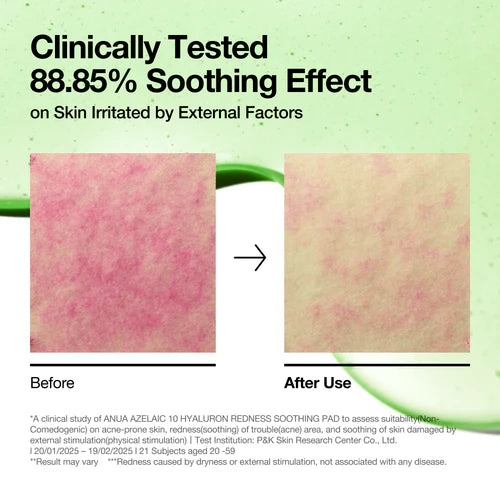 [Anua] Azelaic Acid 10 Hyaluron Redness Soothing Pad (90ea)