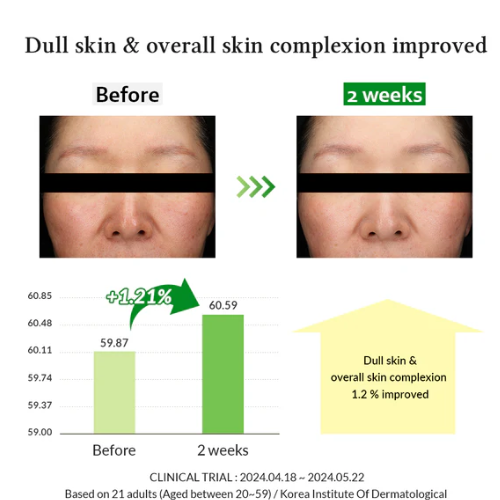[Dr.Althea] Gentle Vitamin C Serum 30ml