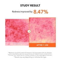 [APRILSKIN] Carrotene Clearing Solution 20ml