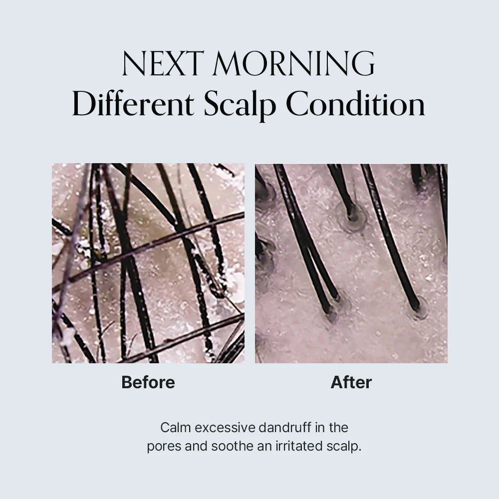[GROWUS] Damage Therapy Scalp Scaling Ampoule 50ml
