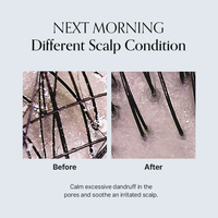 [GROWUS] Damage Therapy Scalp Scaling Ampoule 50ml