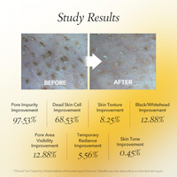 [APRILSKIN] Real Calendula Peel Off Pack 100ml