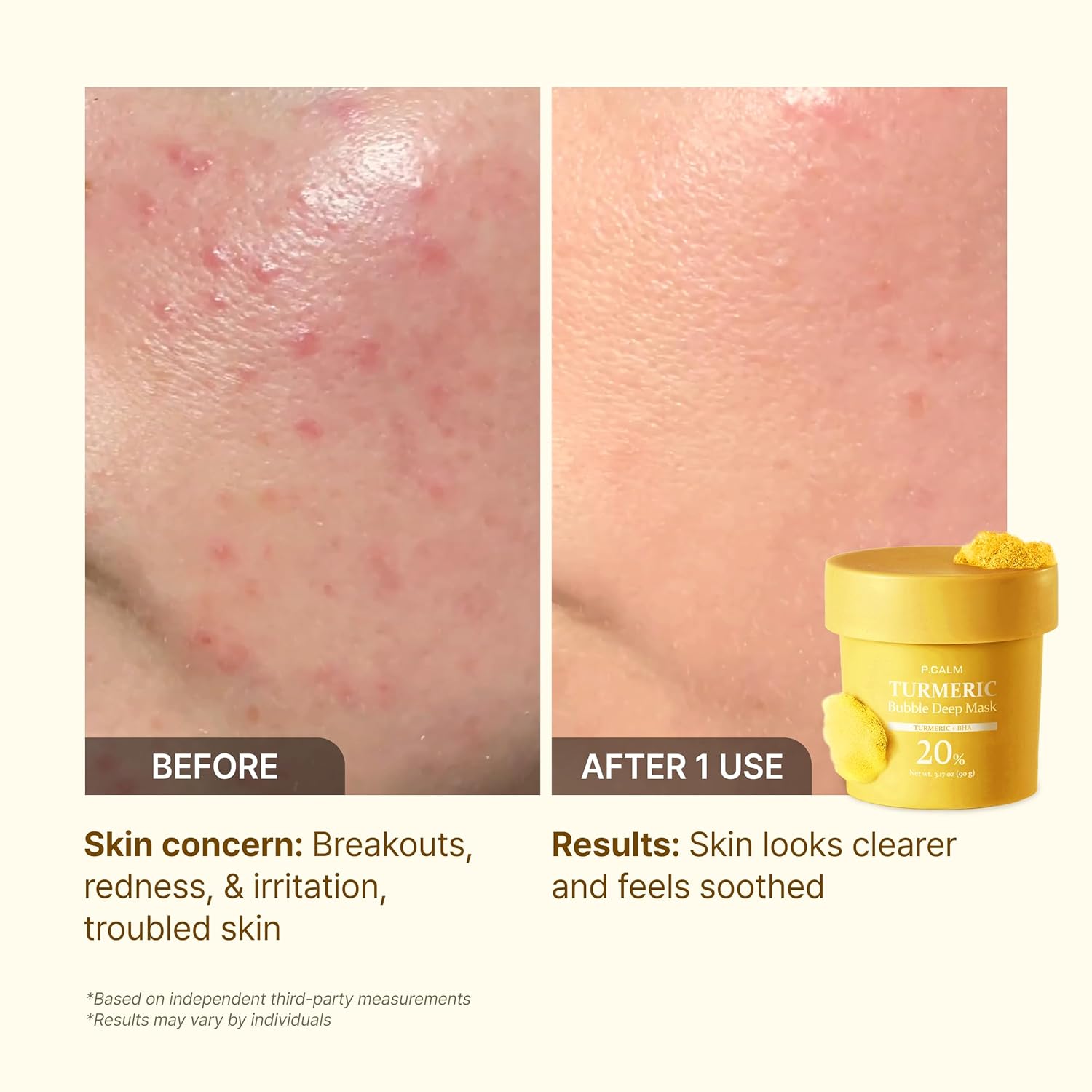 [P.CALM] Turmeric Bubble Deep Mask 90ml
