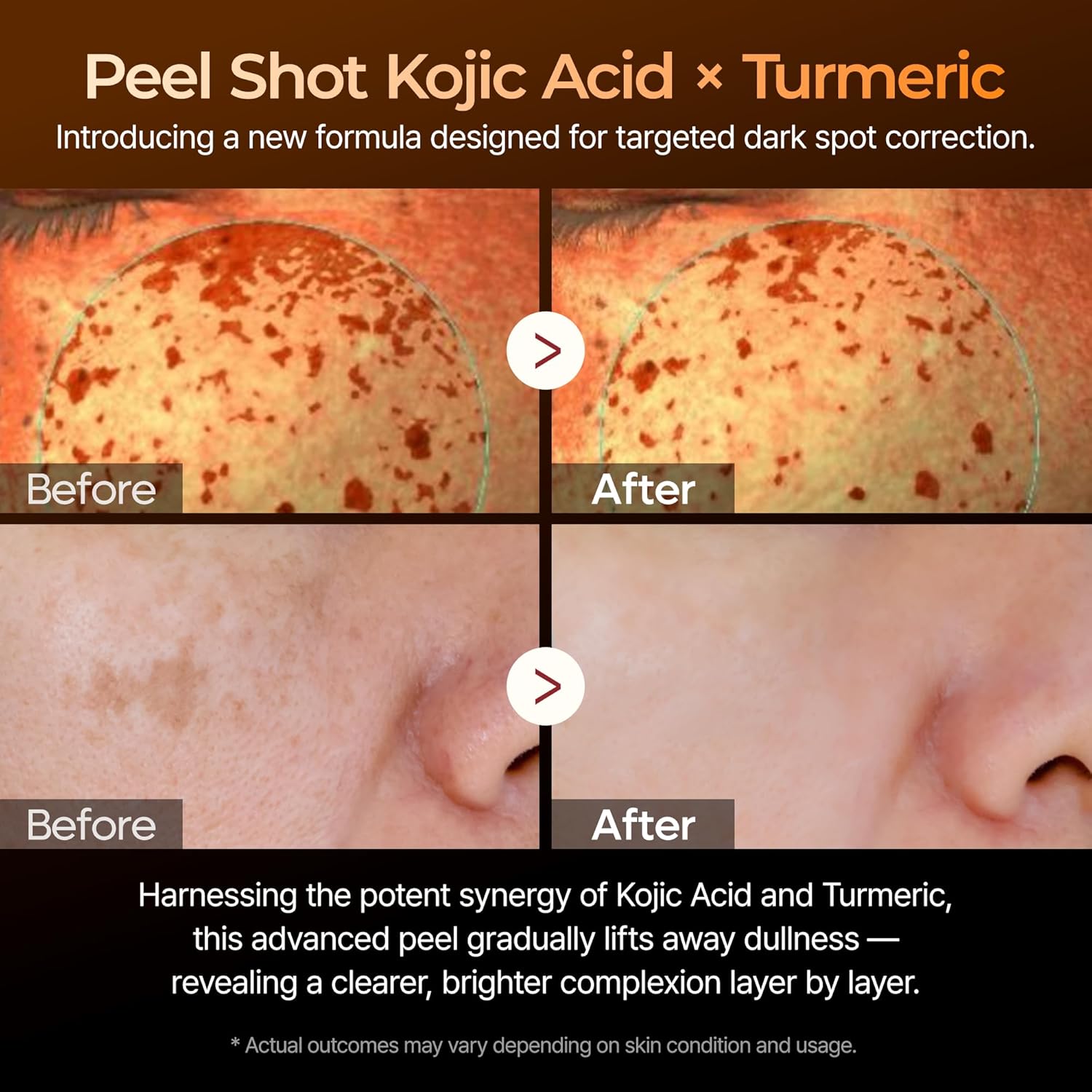 [Dr.Melaxin] Peel Shot Exfoliating Kojic Acid Turmeric Serum 80ml