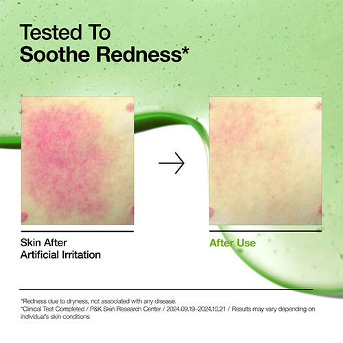 *MOIDA SET* [Anua] Best Seller Serum Duo (Azelaic + TXA)