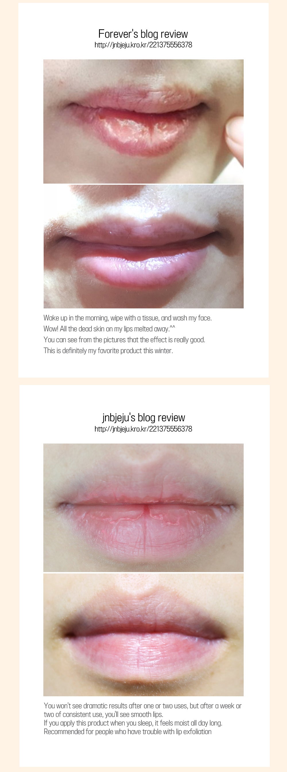 [CARE:NEL] Lip Night Mask 23g (4 types)