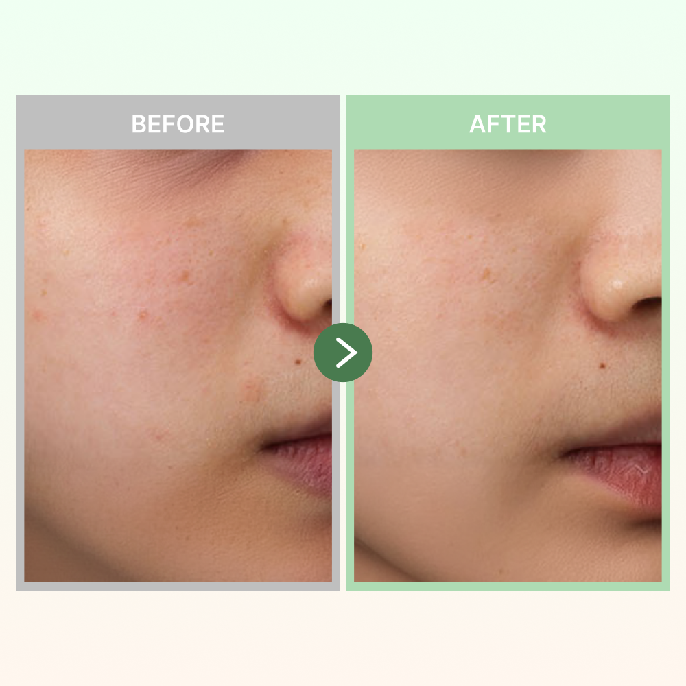 MOIDA BOX [Dr. Althea] Beginner Routine Box for Oily Skin (345 Cream + Vitamin C Serum + Cleansing Balm) *Special Price*