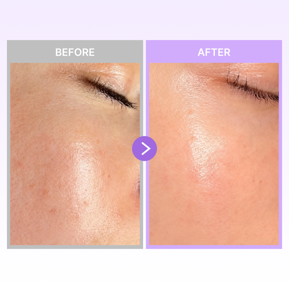 MOIDA SET [Jumiso] Niacinamide Brightening Routine Set for Dark Spots & Uneven Texture (Niacinamide 20 Serum + Toner + Overnight Cream) *Special Price*