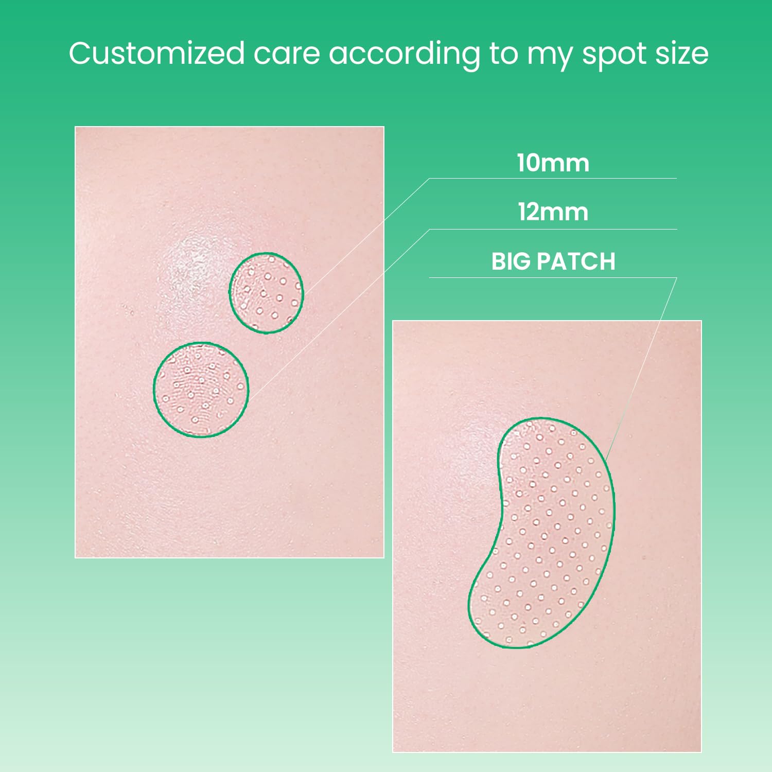 [ILSO] No Problem Spot Patch
