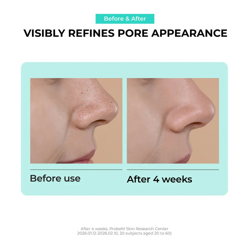 [Jumiso] Overnight Zero Pore Nose Patch (10 patches)