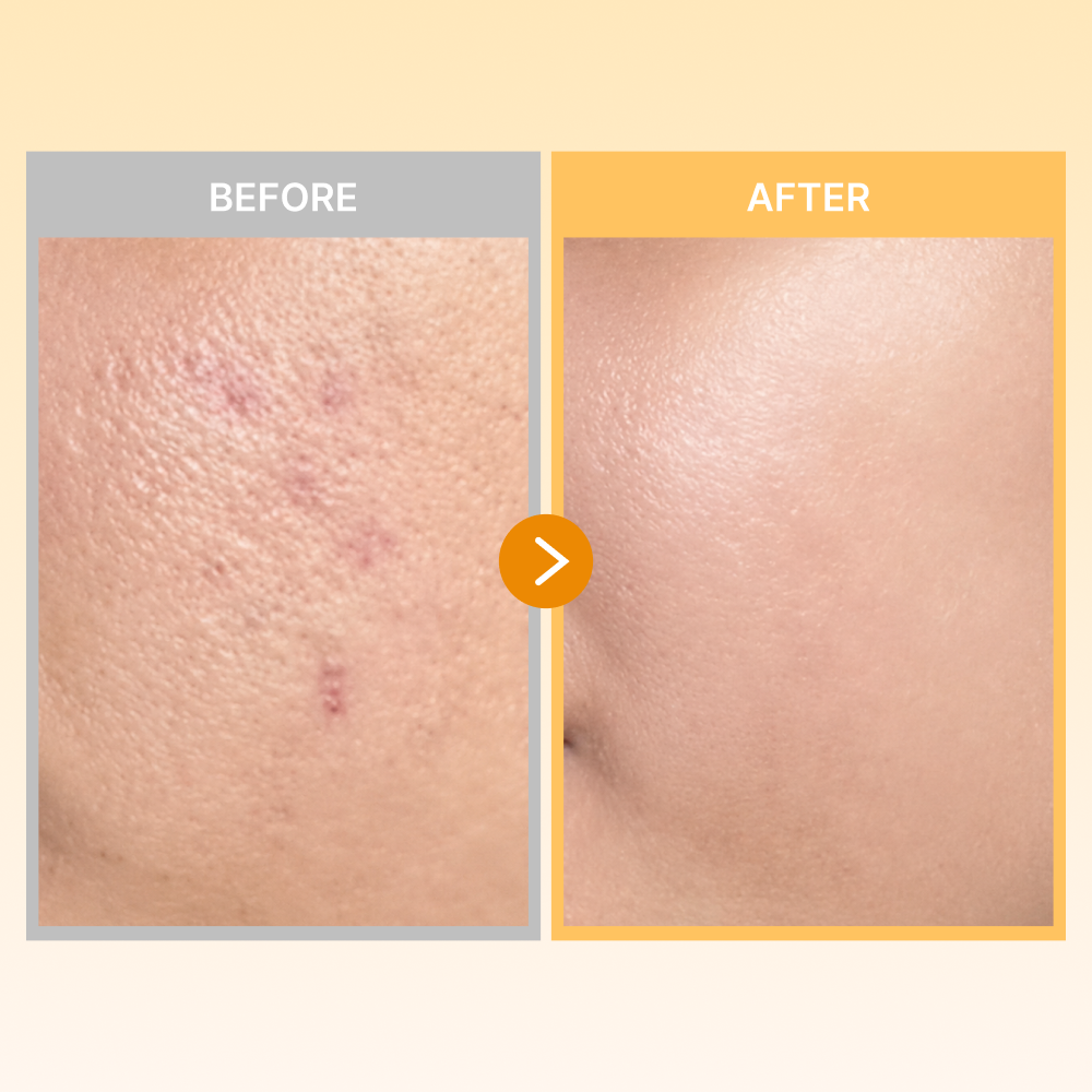 MOIDA SET [MEDICUBE] Kojic Acid + Turmeric Dark Spot Care Routine for Uneven & Dull Skin (Pad + Serum + Cream) *Special Price*