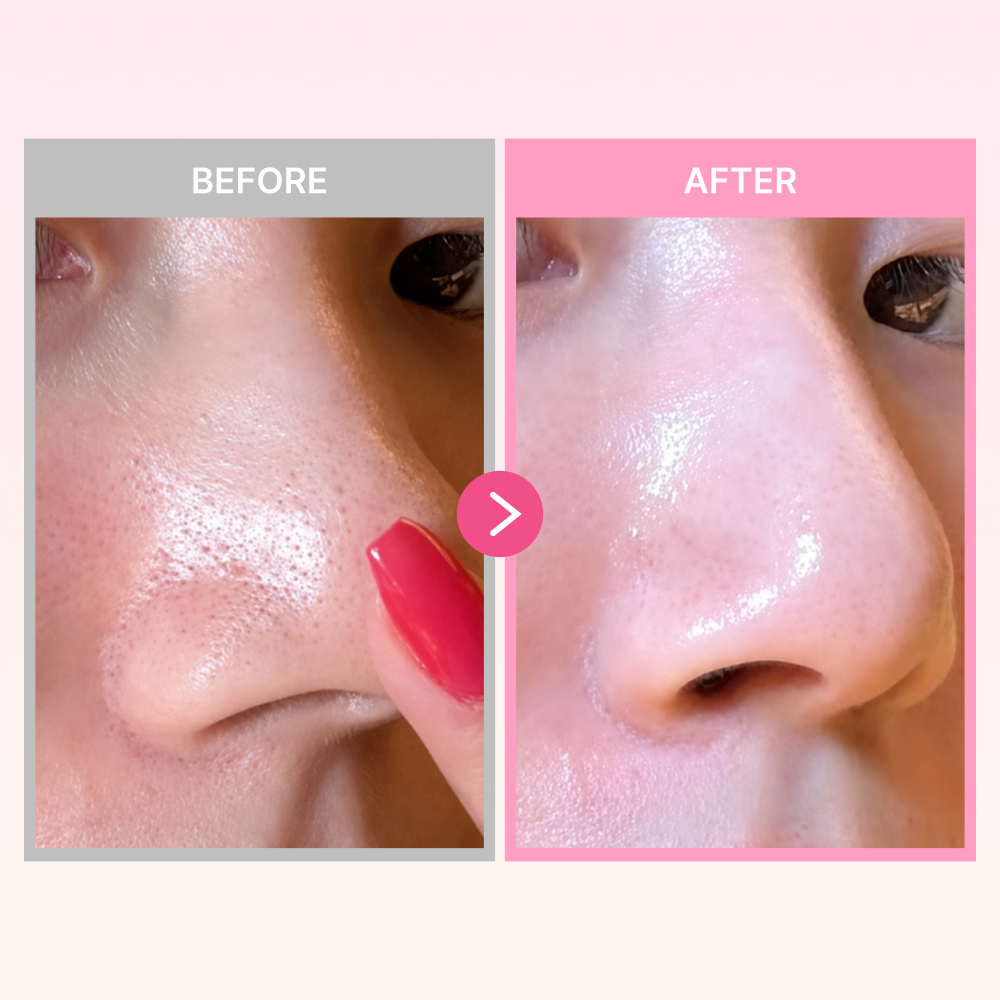 MOIDA BOX [MEDICUBE] Beginner Routine Box for Glow & Poreless Skin (Zero Pore Pad + PDRN Serum + Vita C Cream) *Special Price*