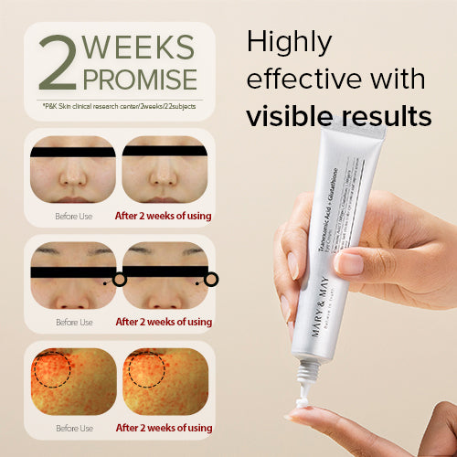Mary & May, Tranexamic Acid + Glutathione Eye Cream Mary & May, Tranexamic Acid + Glutathione Eye Cream