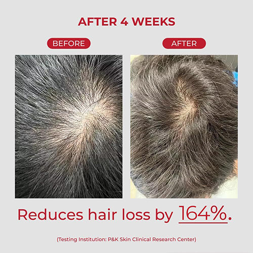 [moev] Annurcatin Shampoo 525ml