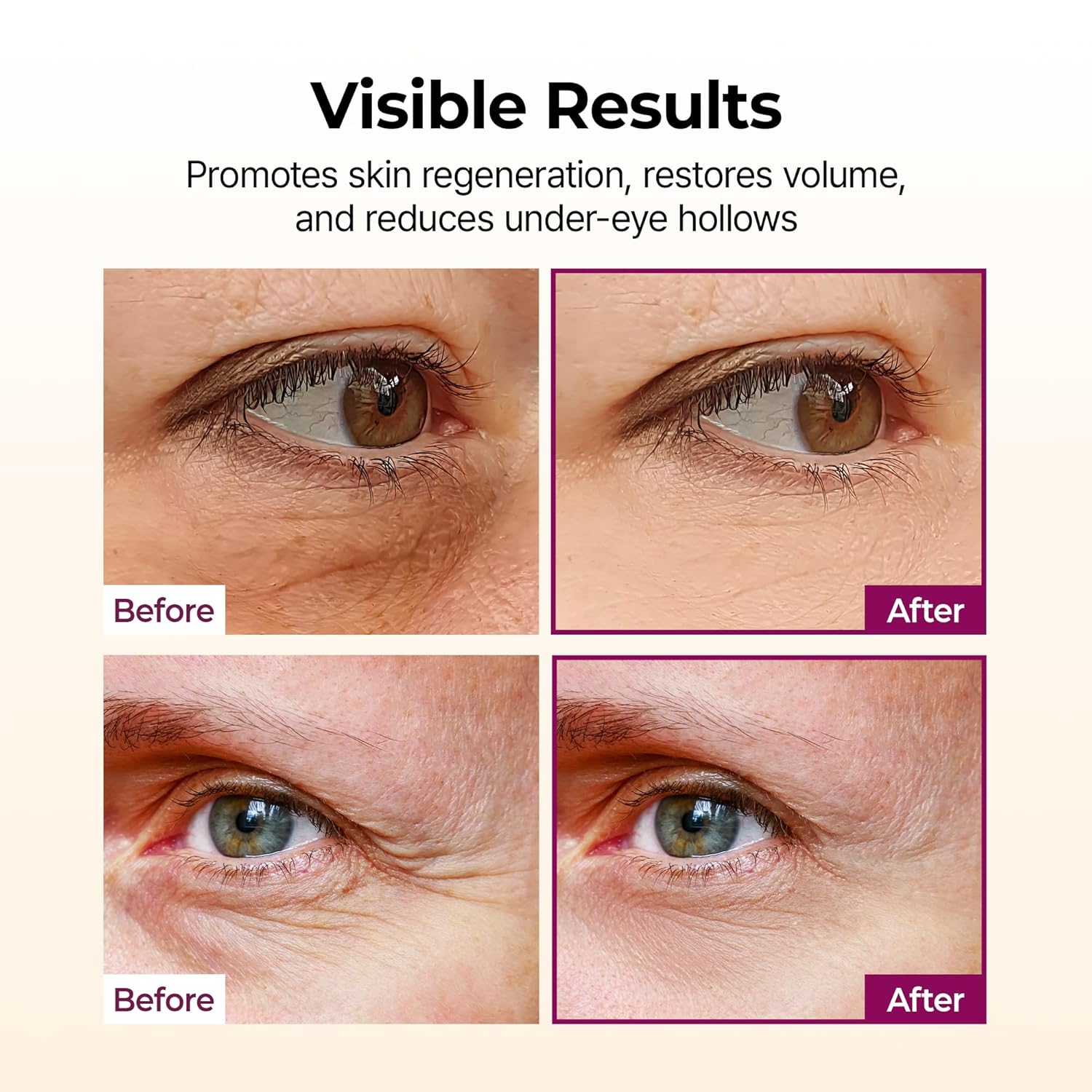 MOIDA SET [MOIDA] Anti-Aging Routine Set *Special Price*