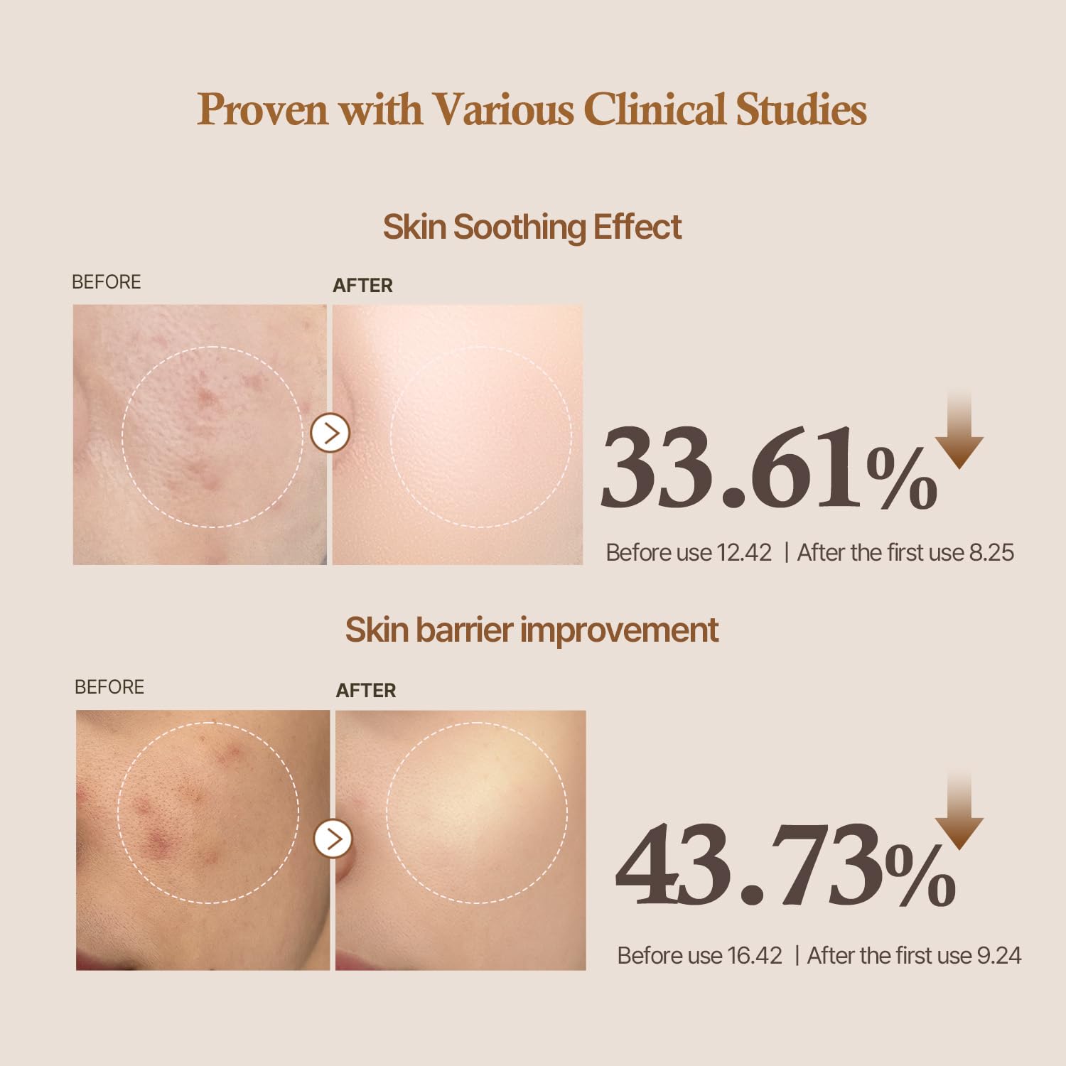 MOIDA SET [MOIDA] PDRN Skin Repair Set *Special Price*