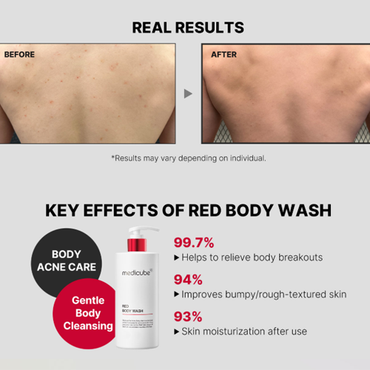 [Medicube] Red Acne Body Wash 2.0 400ml