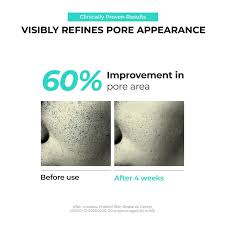 [Jumiso] Overnight Zero Pore Nose Patch (10 patches)