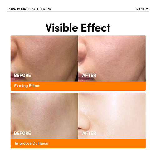 [FRANKLY] PDRN Bounce Ball Serum 30ml