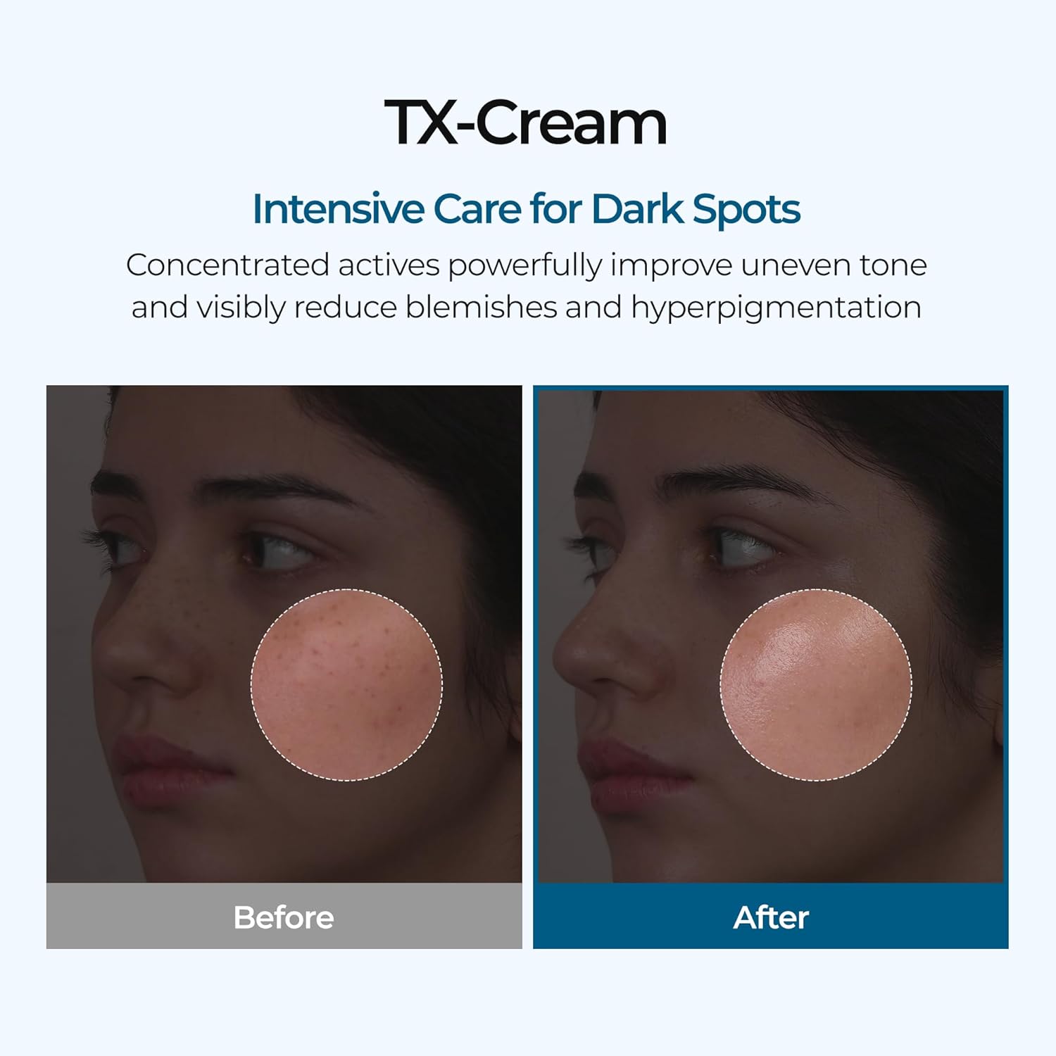MOIDA SET [MOIDA] Hyperpigmentation Fix Duo Set *Special Price*