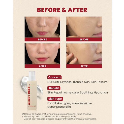 *TIME DEAL* [KSECRET] SEOUL 1988 Essence : Snail Mucin 97% + Rice 100ml